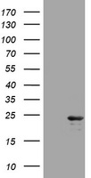 MASPIN Antibody
