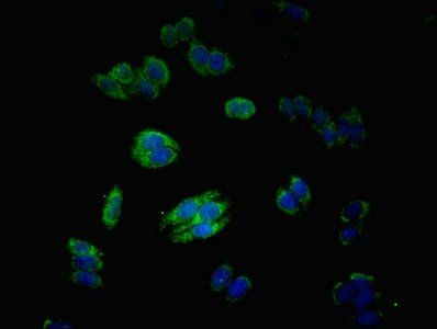 MATN3 Antibody