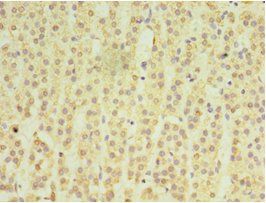 MATN3 Antibody