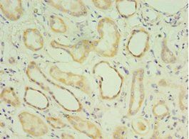 MATN3 Antibody