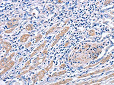MATN3 Antibody
