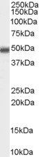 MBD2 (isoform 1) Antibody
