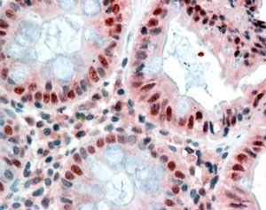 MBD2 (isoform 1) Antibody