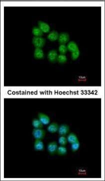 MBNL3 Rabbit Polyclonal Antibody