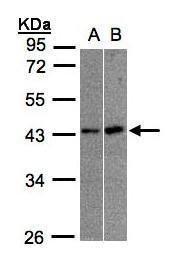 MBNL3 Rabbit Polyclonal Antibody
