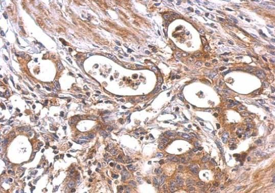 MC1 Receptor Rabbit Polyclonal Antibody