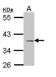 MC1 Receptor Rabbit Polyclonal Antibody
