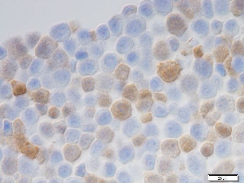 mCherry Antibody