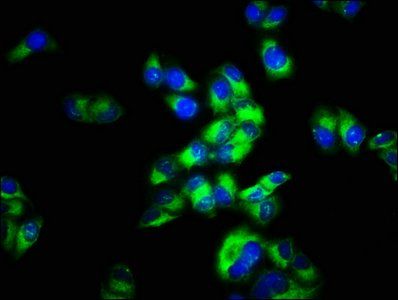 MCHR2 Antibody