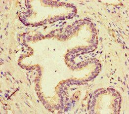 MCIDAS Antibody