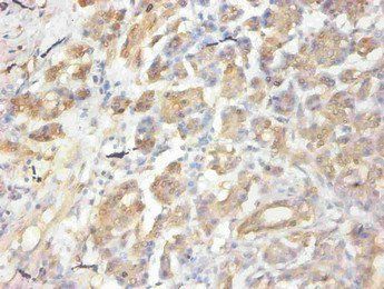 CCL2 Monoclonal Antibody