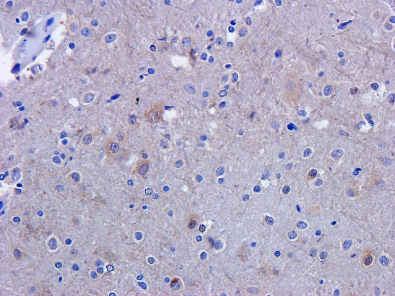 MCP1 antibody