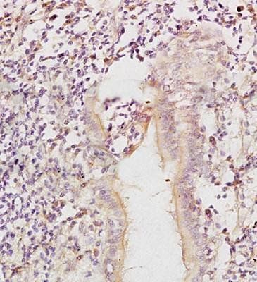 CSF1 Rabbit Polyclonal Antibody