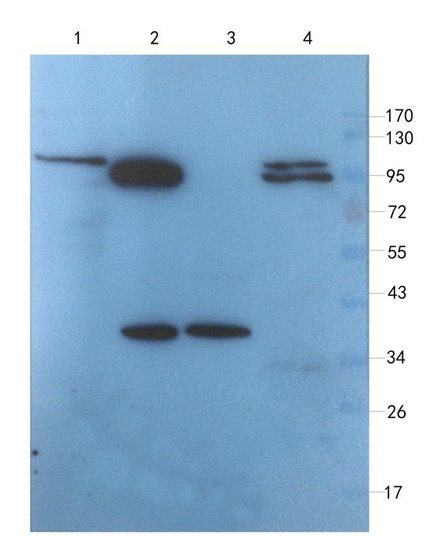 MCU antibody