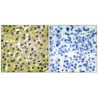 MDM2 Antibody