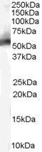 MDM2 (isoform) Antibody