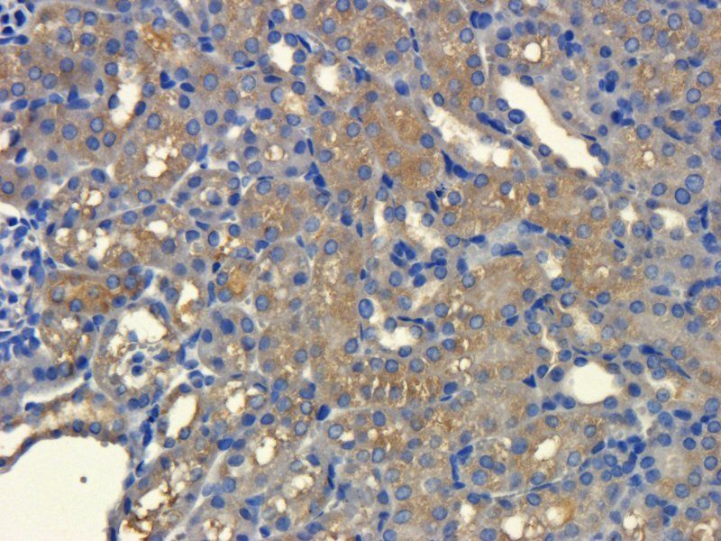 MDR1 antibody