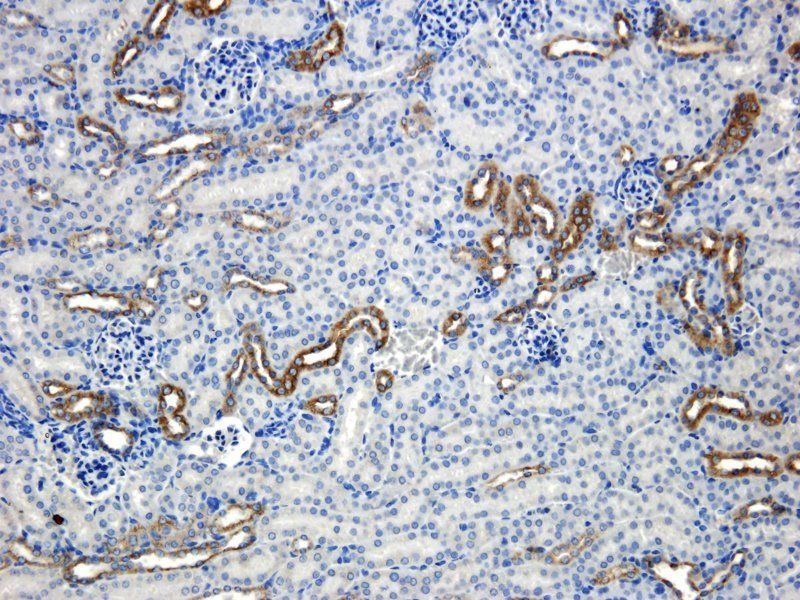 MDR1 antibody