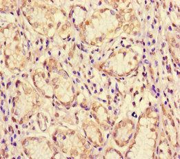 ME1 Antibody