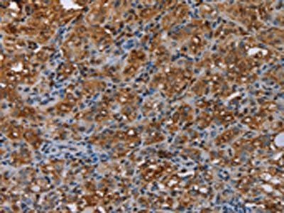 ME1 Antibody
