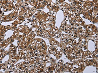 ME1 Antibody