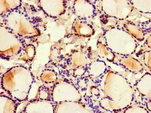 MED1 Antibody