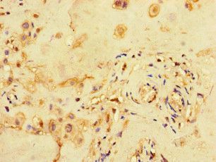 MED1 Antibody