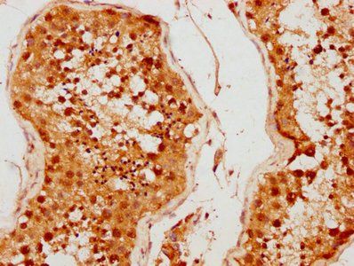 MED26 Antibody