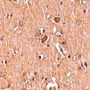 MED28 Rabbit Polyclonal Antibody