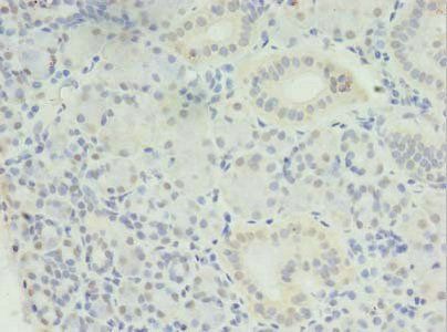 MED30 Antibody
