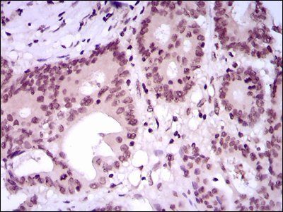 MEF2C Antibody