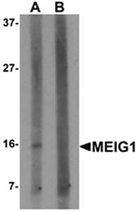 MEIG1 Rabbit Polyclonal Antibody