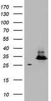 Meis homeobox 3 Antibody