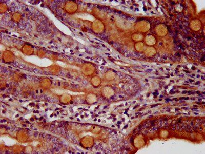 MEIS3 Antibody