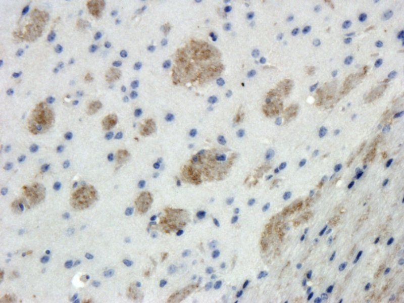 Melatonin Receptor 1B Rabbit Polyclonal Antibody