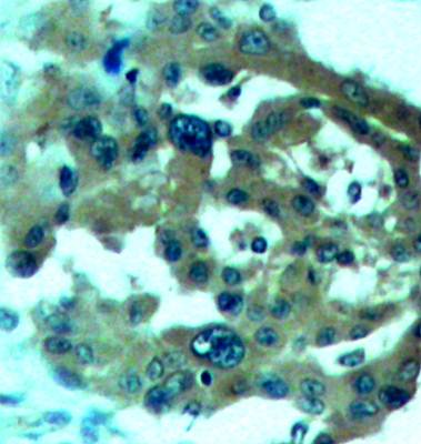 Merlin (Ab-518) Antibody