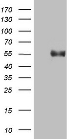 MET Antibody