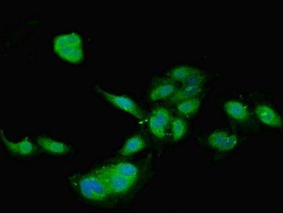 TIMP4 Antibody