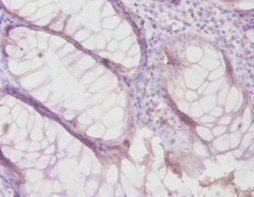 TIMP4 Antibody