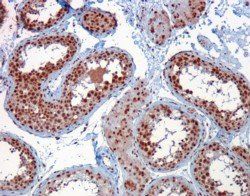 RACGAP1/MgcRacGAP Antibody