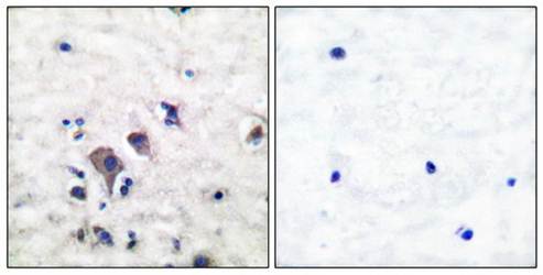 mGluR2/3 Antibody
