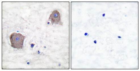 mGluR4 Antibody