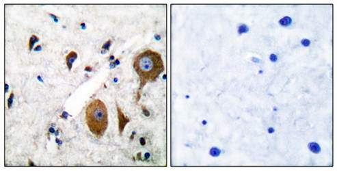 mGluR8 Antibody