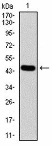 MGMT Antibody