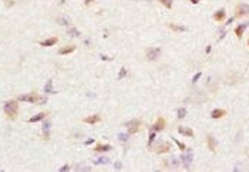 MGMT Rabbit Polyclonal Antibody