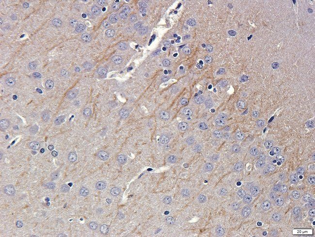 MGT5B Rabbit Polyclonal Antibody