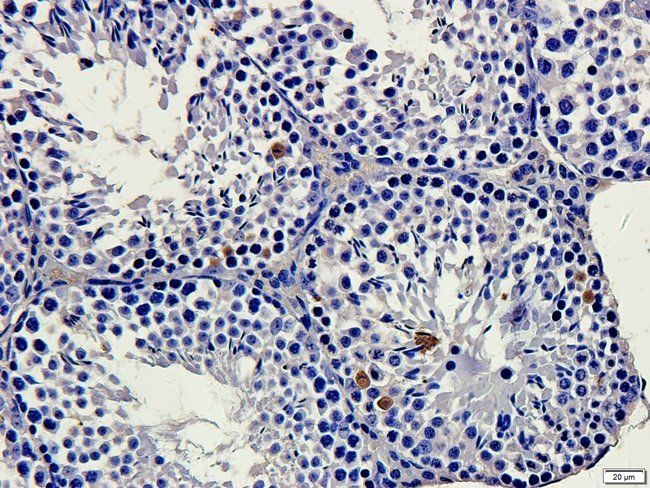 MGT5B Rabbit Polyclonal Antibody