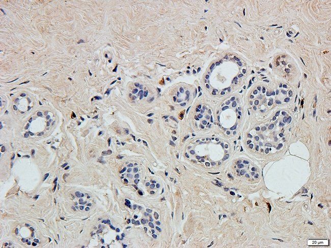 MGT5B Rabbit Polyclonal Antibody