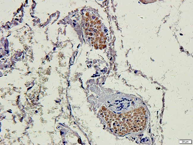 MGT5B Rabbit Polyclonal Antibody
