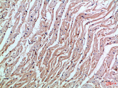 MIA Antibody